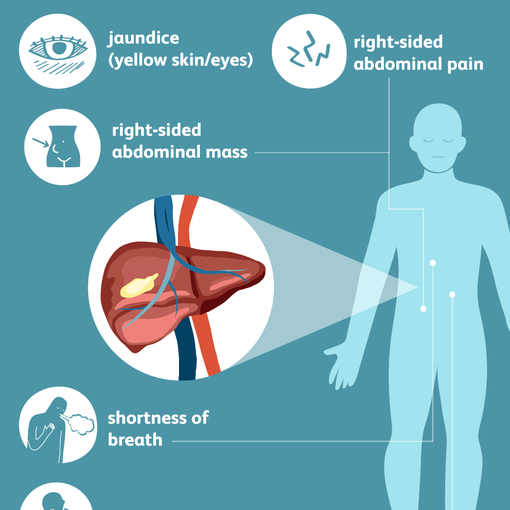 Seventeen sneaky chemicals that may cause breast cancer