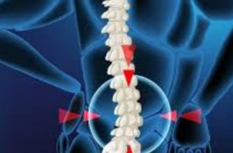 RN Tagore Spine Surgeon: Consultant Neuro & Spine Surgeon in Kolkata