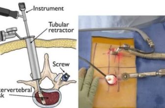 Meet a Minimally Invasive Spine Surgeon in India: Top Spine Surgeon in Kolkata