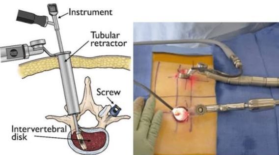 Meet a Minimally Invasive Spine Surgeon in India: Top Spine Surgeon in Kolkata