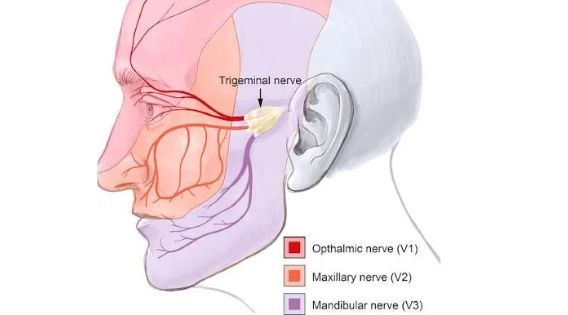 Best Trigeminal Neuralgia Specialist in India: Tips for Living a Normal Life with Trigeminal Neuralgia