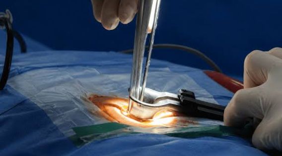 Minimally Invasive Spine Surgery Recovery Time: Consult the Top Spine Surgeon in Kolkata, India